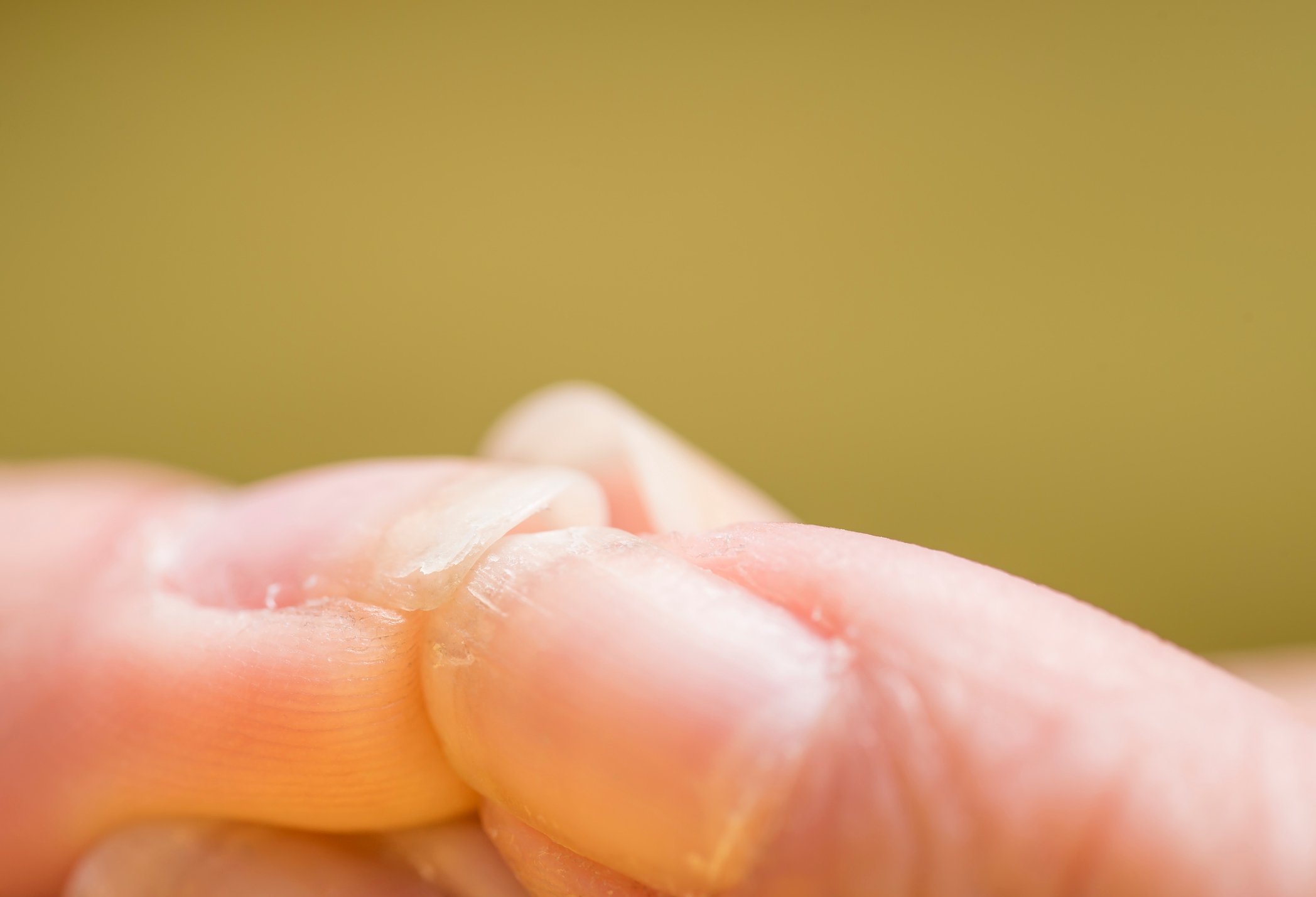 How to avoid yellow nails from nail polish?